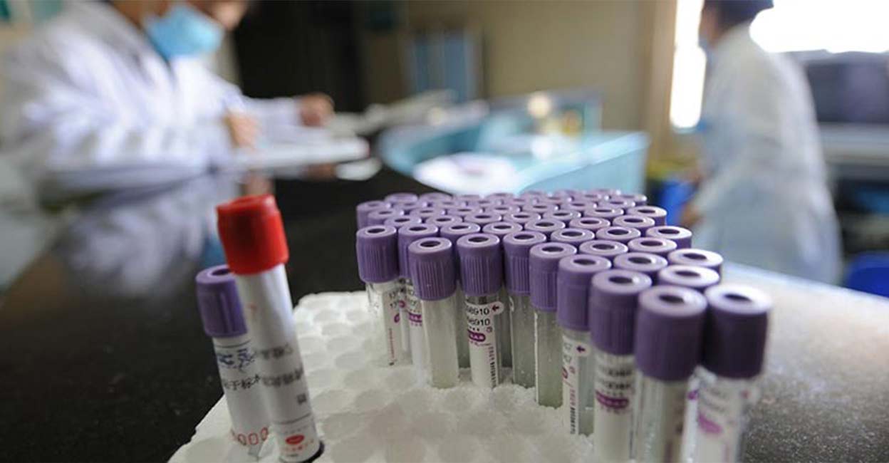 Lab Monoclonal antibodies are immune system proteins that are created in the lab. Photo: AFP